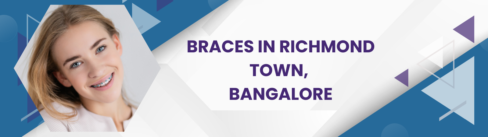 Braces_in_Richmond_Town_Bangalore