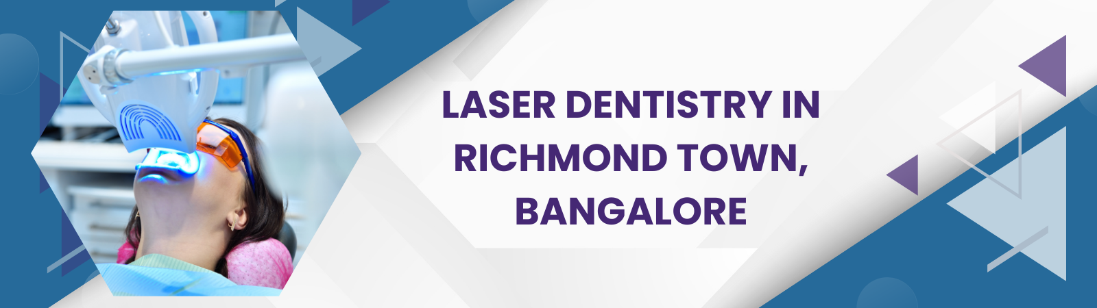 Laser_Dentistry_in_Richmond_Town_Bangalore