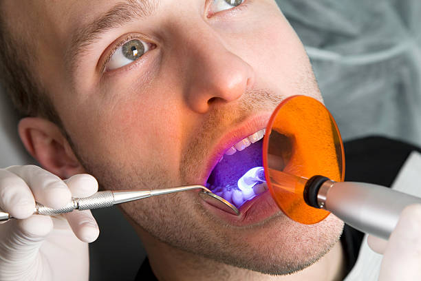 Laser Teeth Whitening